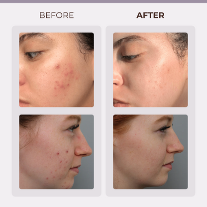 DermaSculpt™ - Facial Contour Wand