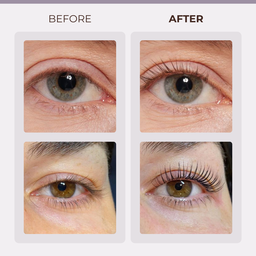 GlowTherm™ - Heated Eyelash Curler